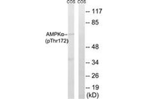 Western blot analysis of extracts from COS7 cells, using AMPK alpha (Phospho-Thr172) Antibody. (AMPK alpha Antikörper  (pThr183))