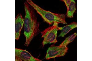 Immunofluorescence (IF) image for anti-Neurofilament, Light Polypeptide (NEFL) antibody (ABIN1108417) (NEFL Antikörper)