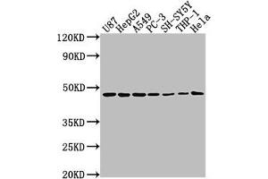 Western Blot Positive WB detected in: U87 whole cell lysate, HepG2 whole cell lysate, A549 whole cell lysate, PC-3 whole cell lysate, SH-SY5Y whole cell lysate, THP-1 whole cell lysate, Hela whole cell lysate All lanes: NDRG1 antibody at 1:2000 Secondary Goat polyclonal to rabbit IgG at 1/50000 dilution Predicted band size: 43, 36, 34 kDa Observed band size: 43 kDa (NDRG1 Antikörper  (AA 136-394))