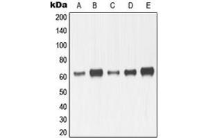 Western blot analysis of MMP14 expression in HeLa (A), HT1080 (B), MDMB23 (C), SP2/0 (D), mouse kidney (E), H9C2 (F) whole cell lysates. (MMP14 Antikörper  (C-Term))