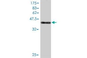 Western Blot detection against Immunogen (45. (DYDC1 Antikörper  (AA 1-177))