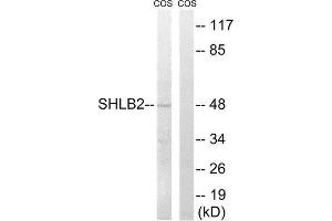 Western Blotting (WB) image for anti-SH3-Domain GRB2-Like Endophilin B2 (SH3GLB2) (Internal Region) antibody (ABIN1852154) (SH3GLB2 Antikörper  (Internal Region))