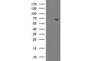 Western Blotting (WB) image for anti-2-Oxoglutarate and Iron-Dependent Oxygenase Domain Containing 1 (OGFOD1) antibody (ABIN1499911) (OGFOD1 Antikörper)