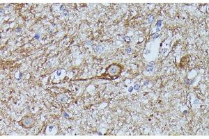 Immunohistochemistry of paraffin-embedded Mouse spinal cord using FKBP1B Polyclonal Antibody at dilution of 1:100 (40x lens). (FKBP1B Antikörper)