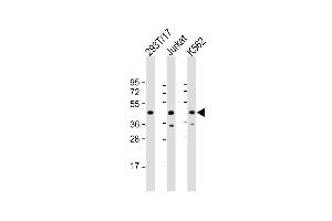 Western Blot at 1:2000 dilution Lane 1: 293T/17 whole cell lysate Lane 2: Jurkat whole cell lysate Lane 3: K562 whole cell lysate Lysates/proteins at 20 ug per lane. (PHF6 Antikörper  (AA 148-180))