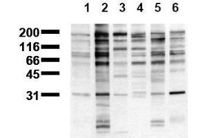 Western Blotting (WB) image for anti-Phosphotyrosine (phosphorylated) antibody (Biotin) (ABIN126872) (Phosphotyrosine Antikörper  (phosphorylated) (Biotin))