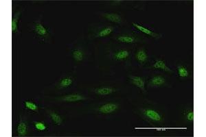 Immunofluorescence of purified MaxPab antibody to DUSP22 on HeLa cell. (DUSP22 Antikörper  (AA 1-184))