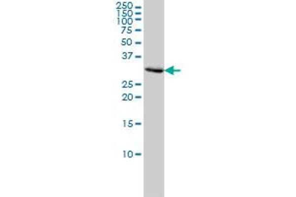 PCNA Antikörper  (AA 1-261)