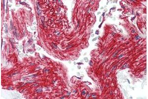 Human Vessel (formalin-fixed, paraffin-embedded) stained with ITGB1 antibody ABIN396958 at 10 ug/ml followed by biotinylated anti-mouse IgG secondary antibody ABIN481714, alkaline phosphatase-streptavidin and chromogen. (ITGB1 Antikörper)