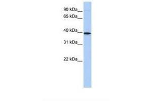 Image no. 1 for anti-Chemokine (C-X-C Motif) Receptor 6 (CXCR6) (N-Term) antibody (ABIN6739084) (CXCR6 Antikörper  (N-Term))