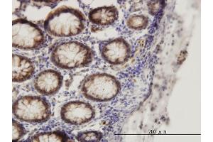 Immunostaining (ISt) image for anti-SMAD, Mothers Against DPP Homolog 1 (SMAD1) (AA 1-465) antibody (ABIN517610)