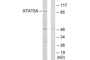 Western blot analysis of extracts from 293 cells, using STAT5A antibody. (STAT5A Antikörper  (Internal Region))