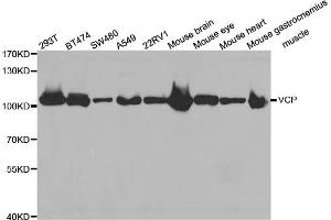 Western blot analysis of extracts of various cell lines, using VCP antibody (ABIN5971478) at 1:300 dilution. (VCP Antikörper)