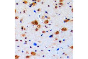 Immunohistochemical analysis of Topoisomerase 3 beta1 staining in human brain formalin fixed paraffin embedded tissue section. (Topoisomerase 3 Beta1 (N-Term) Antikörper)