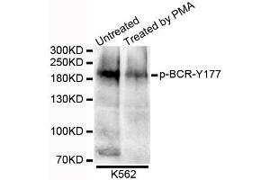 Western blot analysis of extracts of K562 cells, using Phospho-BCR-Y177 antibody. (BCR Antikörper  (pTyr177))