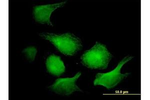 Immunofluorescence of monoclonal antibody to AK1 on HeLa cell. (Adenylate Kinase 1 Antikörper  (AA 1-194))