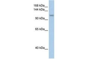 Image no. 1 for anti-PRP6 Pre-mRNA Processing Factor 6 Homolog (PRPF6) (AA 851-900) antibody (ABIN204963) (PRP6/ANT-1 Antikörper  (AA 851-900))