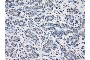 Immunohistochemical staining of paraffin-embedded breast tissue using anti-PPP5C mouse monoclonal antibody. (PP5 Antikörper)