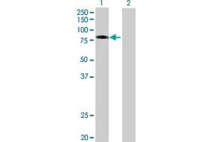 Lane 1: EZR transfected lysate ( 64. (VIL2 293T Cell Transient Overexpression Lysate(Denatured))