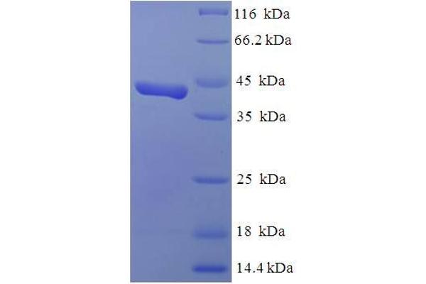 SMARCC1 Protein (AA 449-669) (His-SUMO Tag)