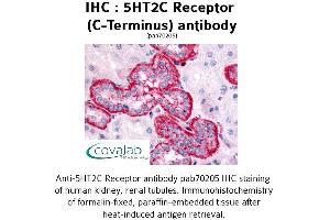 Image no. 1 for anti-5-Hydroxytryptamine (serotonin) Receptor 2C (HTR2C) (C-Term) antibody (ABIN1731369) (HTR2C Antikörper  (C-Term))