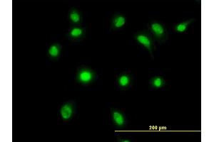 Immunofluorescence of monoclonal antibody to LDB2 on HeLa cell. (LIM Domain Binding 2 Protein Antikörper  (AA 1-373))