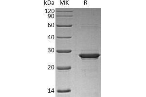 Greater than 95 % as determined by reducing SDS-PAGE. (Oncostatin M Protein (OSM) (His tag))