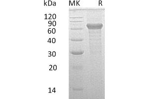 Greater than 95 % as determined by reducing SDS-PAGE. (IL20RB Protein (Fc Tag))
