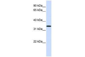 WB Suggested Anti-C16orf78 Antibody Titration: 0. (C16orf78 Antikörper  (Middle Region))