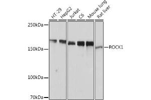 Western blot analysis of extracts of various cell lines, using ROCK1 Rabbit mAb (ABIN6129453, ABIN6135894, ABIN6135895 and ABIN7101375) at 1:1000 dilution. (ROCK1 Antikörper)