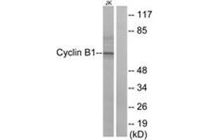 Western blot analysis of extracts from Jurkat cells, treated with UV 15', using Cyclin B1 (Ab-147) Antibody. (Cyclin B1 Antikörper  (AA 121-170))