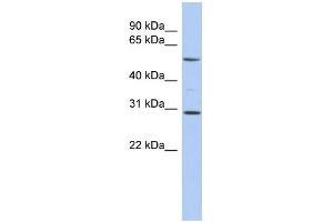 WB Suggested Anti-RELB Antibody Titration:  0. (RELB Antikörper  (Middle Region))
