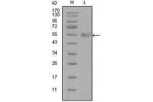 Western Blot showing SYT1 antibody used against truncated Trx-SYT1 recombinant protein (1). (SYT1 Antikörper)
