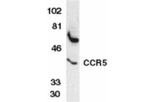 Image no. 2 for anti-Chemokine (C-C Motif) Receptor 5 (CCR5) (AA 6-20) antibody (ABIN319017) (CCR5 Antikörper  (AA 6-20))