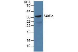 Western blot analysis of recombinant Rat SOX18. (SOX18 Antikörper  (AA 153-377))