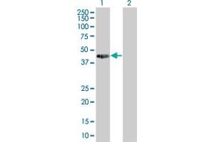 Western Blotting (WB) image for TCEA2 293T Cell Transient Overexpression Lysate(Denatured) (ABIN1333663)