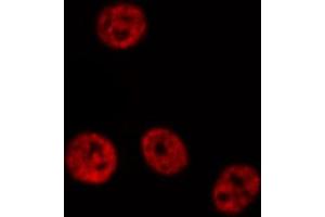 ABIN6267674 staining HepG2 by IF/ICC. (PDCD4 Antikörper  (pSer457))