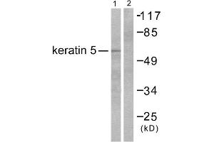 Western Blotting (WB) image for anti-Keratin 5 (KRT5) (C-Term) antibody (ABIN1848638) (Cytokeratin 5 Antikörper  (C-Term))