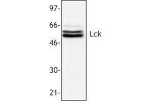 Western Blotting (WB) image for anti-Lymphocyte-Specific Protein tyrosine Kinase (LCK) antibody (ABIN2665225) (LCK Antikörper)