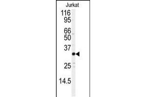 Western blot analysis of anti-JUND Antibody (S255) in Jurkat cell line lysates (35ug/lane) (JunD Antikörper  (AA 233-262))