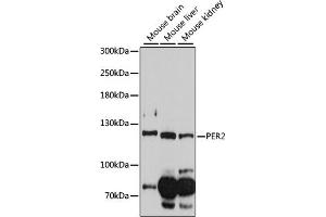 Western blot analysis of extracts of various cell lines, using PER2 antibody (ABIN6134741, ABIN6145451, ABIN6145453 and ABIN6218314) at 1:1000 dilution. (PER2 Antikörper  (AA 1-100))