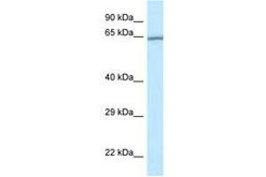 Image no. 1 for anti-RAS Guanyl Releasing Protein 4 (RASGRP4) (AA 149-198) antibody (ABIN6747687) (RASGRP4 Antikörper  (AA 149-198))