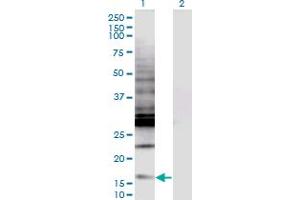 Western Blot analysis of CREBL2 expression in transfected 293T cell line by CREBL2 monoclonal antibody (M04), clone 1C1. (CREBL2 Antikörper  (AA 1-120))