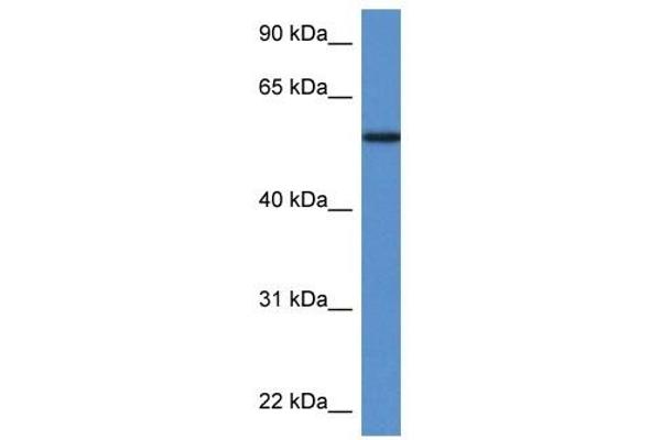 Phosphoglucomutase 5 Antikörper  (N-Term)