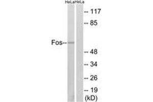 Western blot analysis of extracts from HeLa cells, using Fos (Ab-374) Antibody. (c-FOS Antikörper  (AA 331-380))