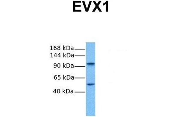 EVX1 Antikörper  (N-Term)