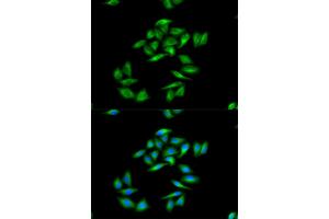 Immunofluorescence analysis of MCF-7 cells using CPT1A antibody. (CPT1A Antikörper)