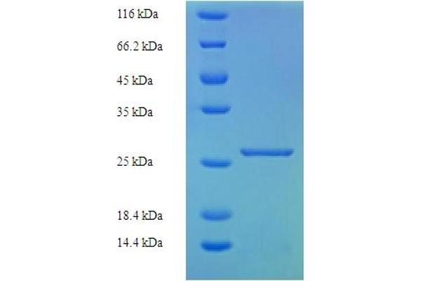 KIR2DS1 Protein (AA 22-245) (His tag)