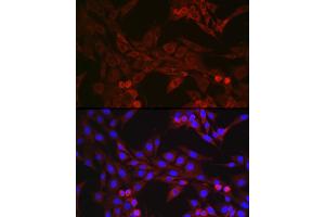 Immunofluorescence analysis of NIH/3T3 cells using GSDMD (Full Length+C terminal) Rabbit pAb (ABIN7267350) at dilution of 1:250 (40x lens). (GSDMD Antikörper  (AA 276-484))