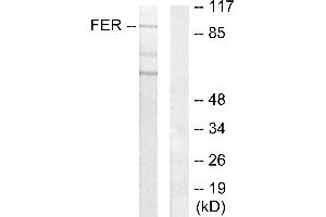 Western blot analysis of extracts from HeLa cells, using FER antibody. (FER Antikörper)